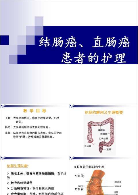 结肠癌直肠癌患者的护理护理查房PPT